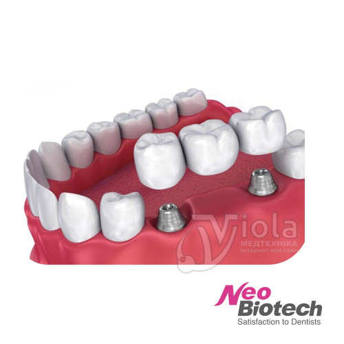 Цилиндр CAD CAM мультиюнит абатмента, Neobiotech,