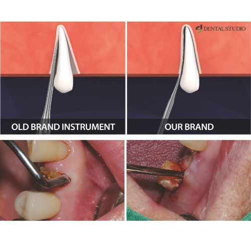 «Легкий» периотом 3305, Dental Studio