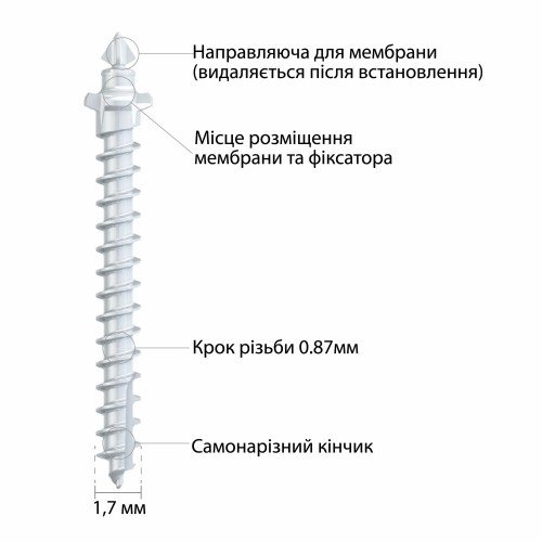 Фиксирующий винт и  фиксатор  EZ, Neobiotech