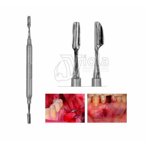 Набор для тунельной техники др. Янг, Dental Studio