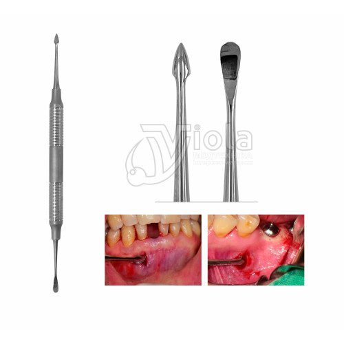 Набор для тунельной техники др. Янг, Dental Studio