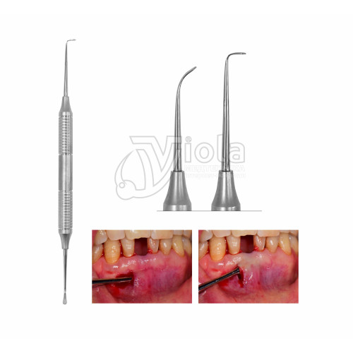 Набор для тунельной техники др. Янг, Dental Studio