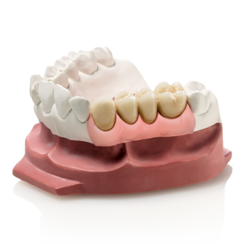 А-силикон мягкий GINGIFAST ELASTIC, 2 картриджа по 50мл