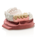 А-силикон мягкий GINGIFAST ELASTIC, 2 картриджа по 50мл