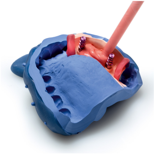 А-силикон твердый GINGIFAST RIGID, 2 картриджа по 50мл