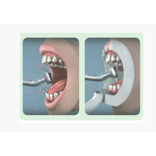 Ретрактор губ с отсосом Oral BioFilter